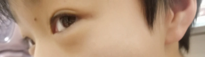 B r o＇s   eyes